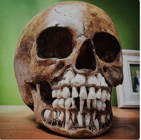 لقطة من_craniac_ لجمجمة طفل تظهر جميع أسنانها اللبنية في مكانها ، بينما أسنانها البالغة في انتظار القدوم.