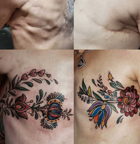 tetování, tetování, tetování, inspirace tetováním, nápad na tetování, rakovina prsu, tetování mastektomií, napuštěné inkoustem, inkoustovým mágem