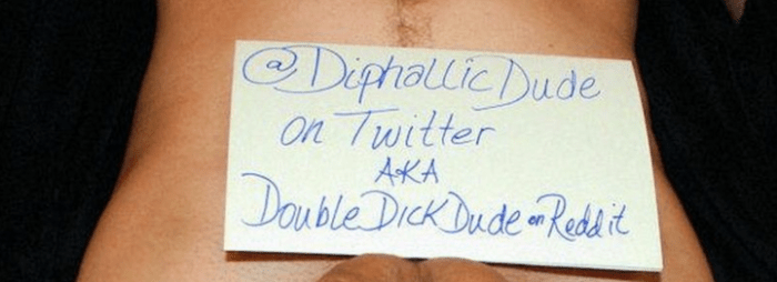 صورة عبر Diphallic Dude