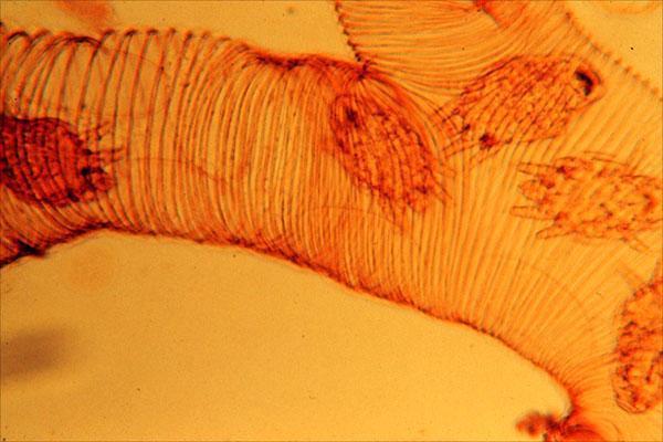 Dommages aux voies respiratoires des abeilles - acarapidose