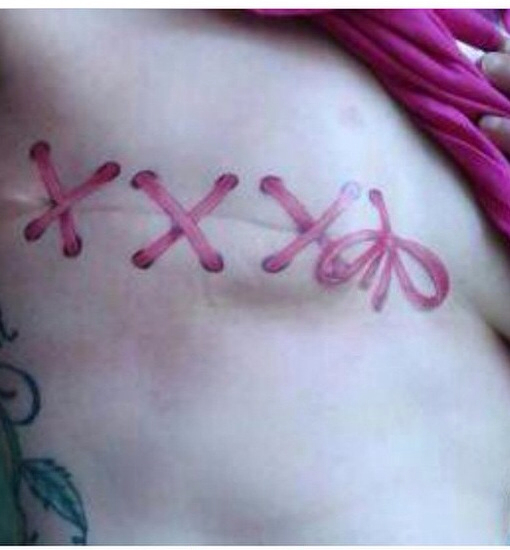 Brustkrebs-Tattoos, die Leben verändert haben und helfen, sie zu retten