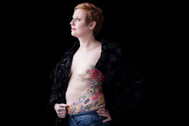 (Foto: Cancer Research) Nachdem Nina Cristinacce sich wegen der Narben ihres Kampfes gegen den Krebs verunsichert fühlte, beschloss sie, ihre Narben mit einem Tattoo zu bedecken. „Ich dachte, es könnte mir helfen, mich selbst ein bisschen mehr zu mögen, vielleicht wieder mit jemandem auszugehen und mich wohl zu fühlen.