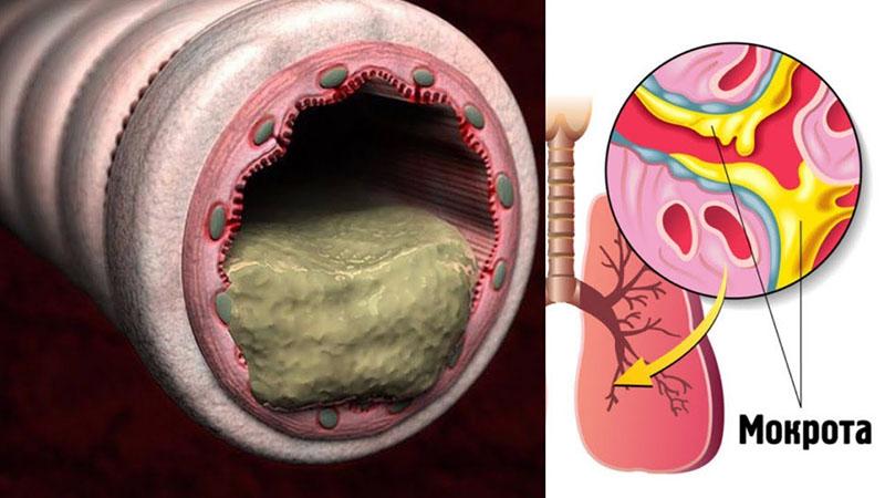 limpieza de vasos sanguíneos y excreción de esputo