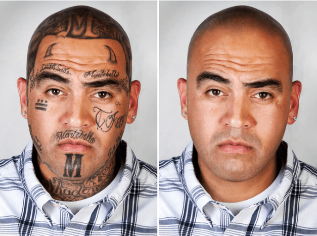 Mann mit entfernten Gang-Tattoos