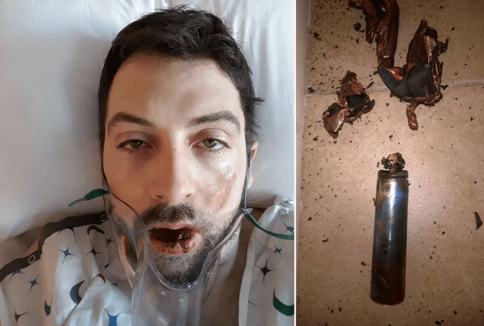 Ein weiterer bekannter Vorfall einer Explosion eines Vape-Pens ereignete sich im Januar 2017, bei der einem 30-jährigen Mann aus Idaho sieben Zähne ausgeschlagen und seine Haut verbrannt wurde.