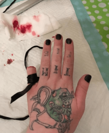Torz Reynolds Finger abgeschnitten Pinky Body Mods Tattoos