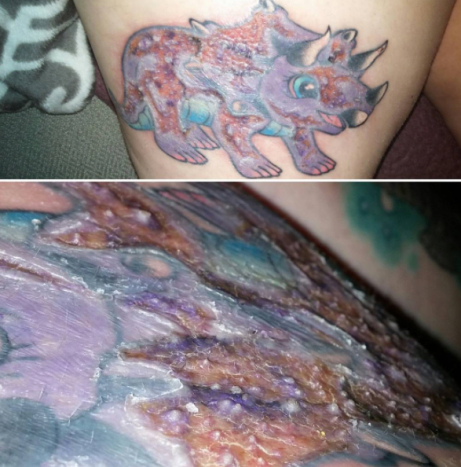 schwer infiziertes Dinosaurier Tattoo