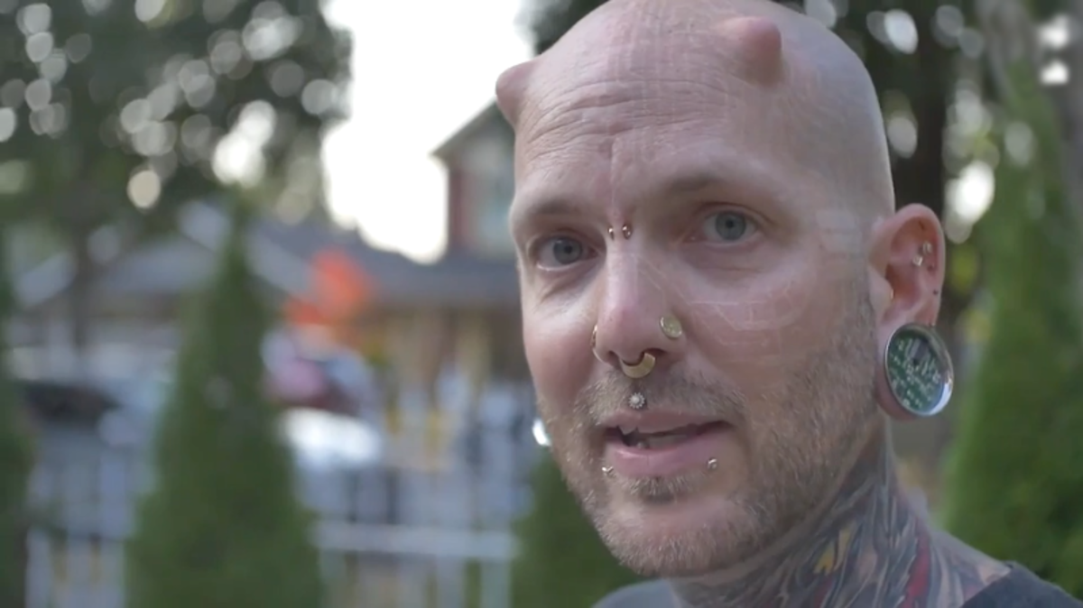 Russ foxx, lidský kyborg, extrémní úpravy těla, chirurgické implantáty, inkoustový zásobník