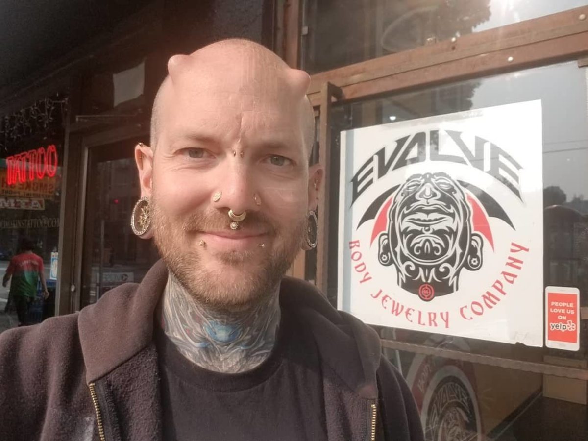 Russ foxx, lidský kyborg, extrémní úpravy těla, chirurgické implantáty, inkoustový zásobník
