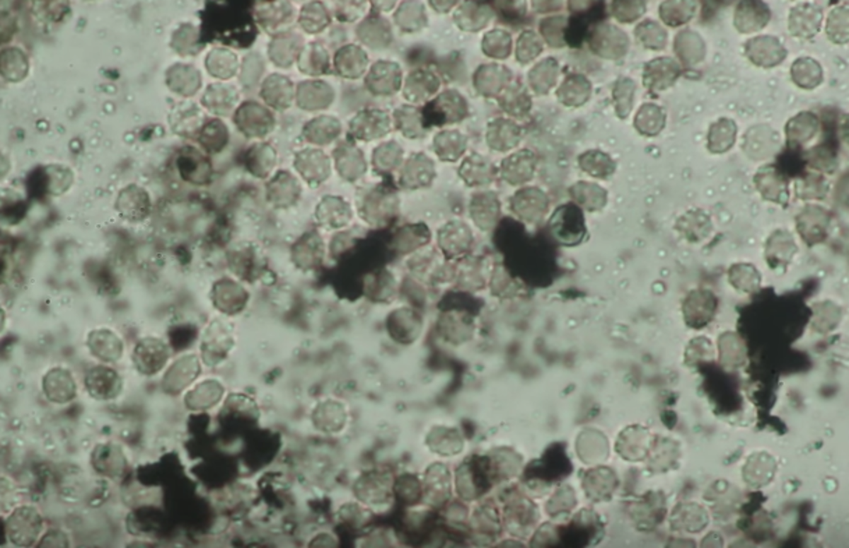 inkoust na tetování a bílé krvinky pod mikroskopem