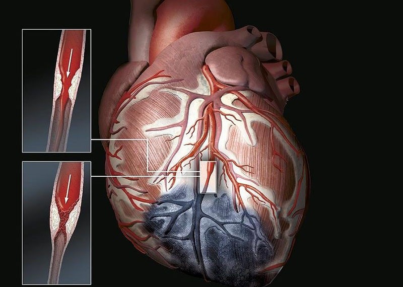 efecto cardiotónico