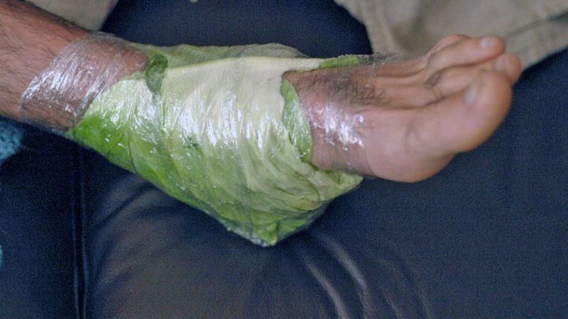 traitement des pieds