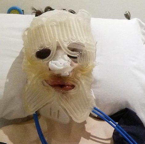 Foto přes @missxronix V roce 2014 se Blades dostal pod nůž na operaci feminizace obličeje provedenou ve španělské Marbelle.