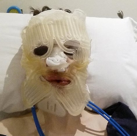 Foto via @missxronixIm Jahr 2014 ging Blades für eine Gesichtsfeminisierungsoperation in Marbella, Spanien, unters Messer.
