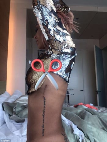 هذا صحيح ، لقد أزال جراح التجميل الوشم.
