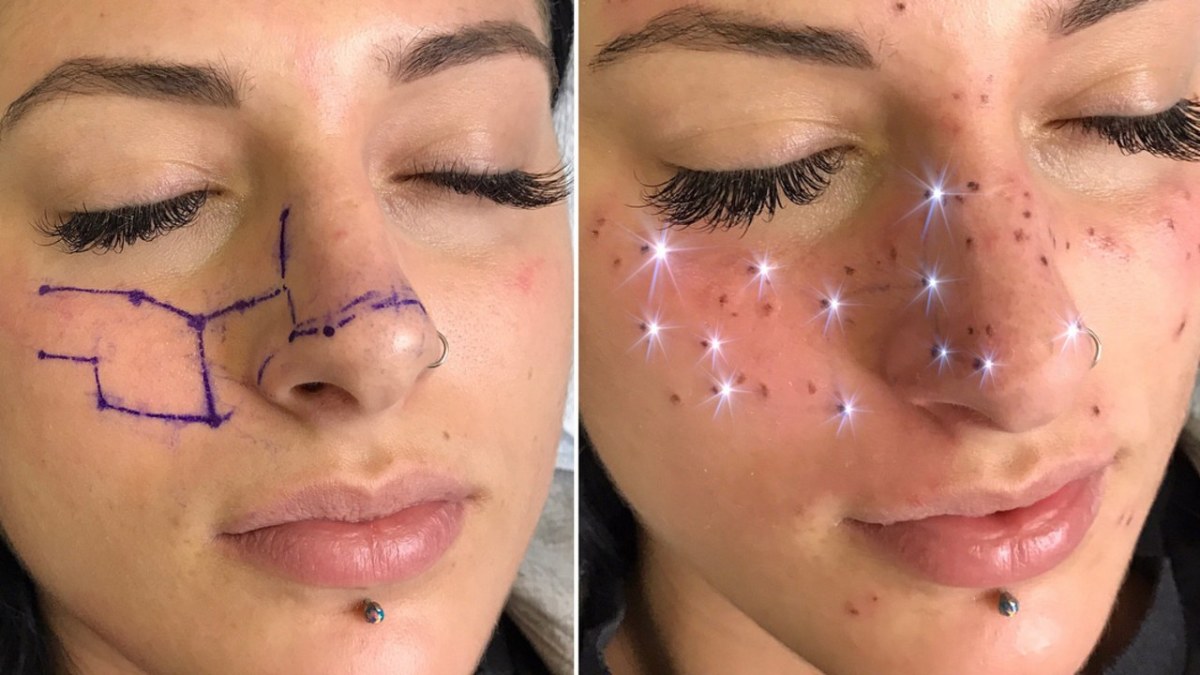Schönheitschirurgie, kosmetische Tätowierungen, Microblade-Tattoos, Microblading, Sommersprossen-Tattoos, Augenbrauen-Tattoos