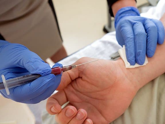 Foto via medistudentsObwohl ich diesen Test aus erster Hand erlebt habe, kann ich Ihnen keinen First-Person-Account geben...dies ist der Test, bei dem ich untergegangen bin. Bei diesem Test wird Blut nicht aus einer Vene, sondern direkt aus der Arterie in Ihrem Handgelenk entnommen, um den Säure- und Sauerstoffgehalt des Blutes zu messen. Wenn ein Arzt zugibt, dass dies schmerzhaft sein kann, wissen Sie, dass es so sein wird.