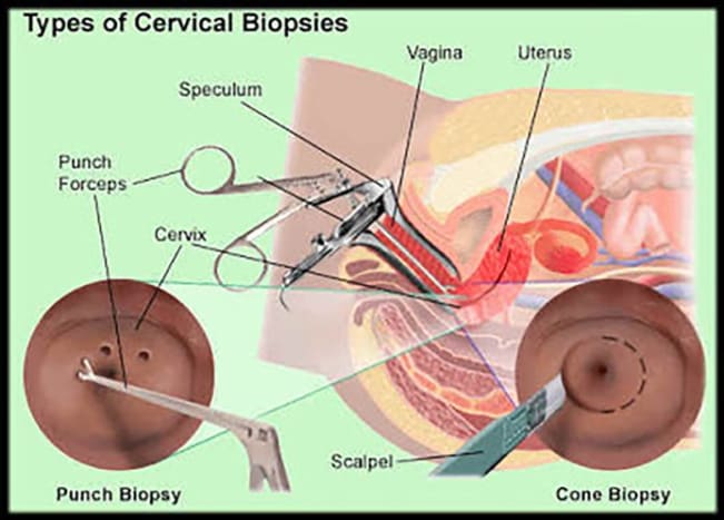 الصورة عبر Milam Urology يقع هذا الاختبار تحت