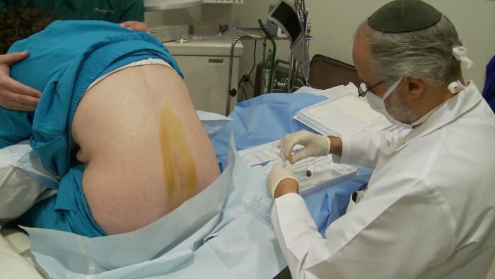 Foto über www.youtubeDie Beschreibung dieses Tests ist schmerzhaft, nur darüber zu schreiben. Ich werde mich kurz fassen, um das Zusammenzucken auf unseren beiden Seiten nicht zu verlängern. Der Patient liegt auf einem Tisch oder beugt sich über eine Stütze, sodass die Wirbel leicht getrennt sind. Dann wird eine lange dünne Nadel zwischen die beiden Wirbel eingeführt, um Liquor aus dem Spinalkanal zu entnehmen. Die entnommene Flüssigkeit wird auf bestimmte Infektionen und Krebsarten untersucht. Glücklicherweise ist der Schmerz jetzt mit örtlicher Betäubung nur das erste Durchstechen, aber das Konzept ist unglaublich schmerzhaft, wenn man darüber nachdenkt.