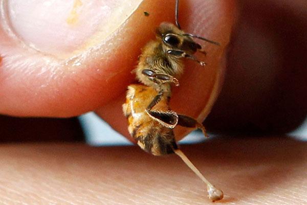 L'abeille a lâché un dard