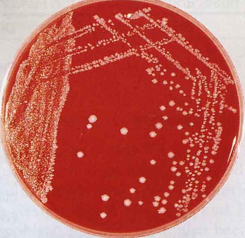 agent causal de la maladie bactérie pasteurella