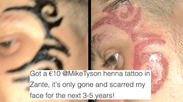 Při návštěvě Zante v Řecku se Colley rozhodl, že by bylo zábavné nechat si na tvář s Hennou vytetovat „Tysonovo tetování“. Vidlicově převýšil 11 dolarů a černé tetování Hennou bylo položeno. O několik hodin později to začalo svědit a pálit. Hennu smyl, aby odhalil, co se stane jizvou, která bude trvat 3–5 let.