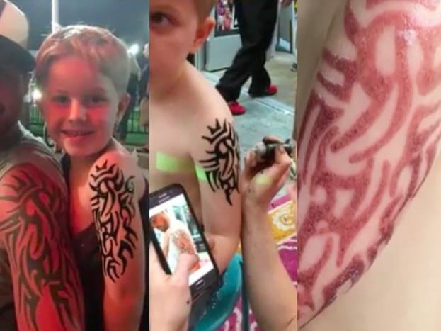 Foto über DearlyWährend seines Urlaubs am Strand von Oceanfront Virginia Beach ließ sich die Mutter des fünfjährigen Peyton Knauser ein temporäres Henna-Tattoo passend zu dem seines Vaters stechen. Ein paar Tage später begann die Tinte zu verblassen, aber was zurückblieb, war schmerzhafte rote, polternde Haut.