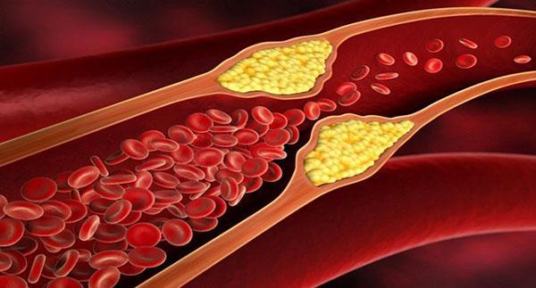 reduce los niveles de colesterol en sangre