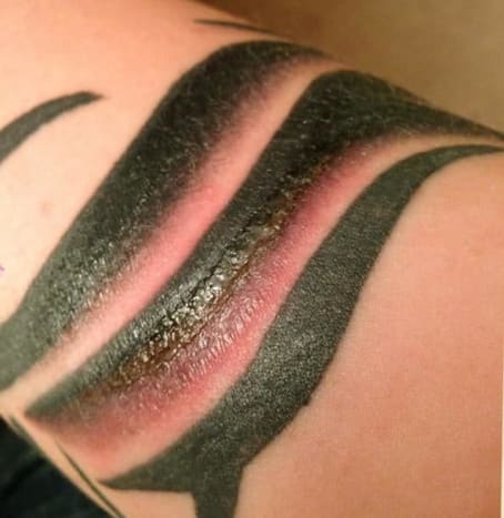 Da das Tattoo einige tiefe Schichten der Epidermis (obere Schicht) und Dermis (mittlere Schicht) des Hautgewebes der Luft, Wasser, Schmutz usw. ausgesetzt hat, ist Ihre frische Tinte die Zeit, in der sie am anfälligsten für eine Infektion ist. Das ist nicht cool. Wenn sich der Bereich also infiziert, kann es neben dem Juckreiz auch zu Schwellungen, Rötungen und sogar zu Ausfluss kommen. Wenn die Infektion schwer genug ist, können Sie Fieber und Schüttelfrost bekommen. Dies rechtfertigt einen Arztbesuch.