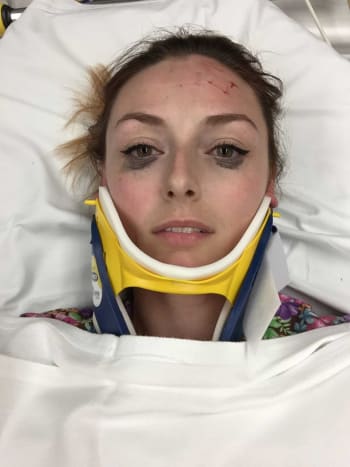 Ihr Eyeliner ging viral, als sie nach einem Autounfall ein Bild von sich teilte. Das Internet kann buchstäblich nicht damit umgehen, wie perfekt ihr Liner unter den gegebenen Umständen aussieht.