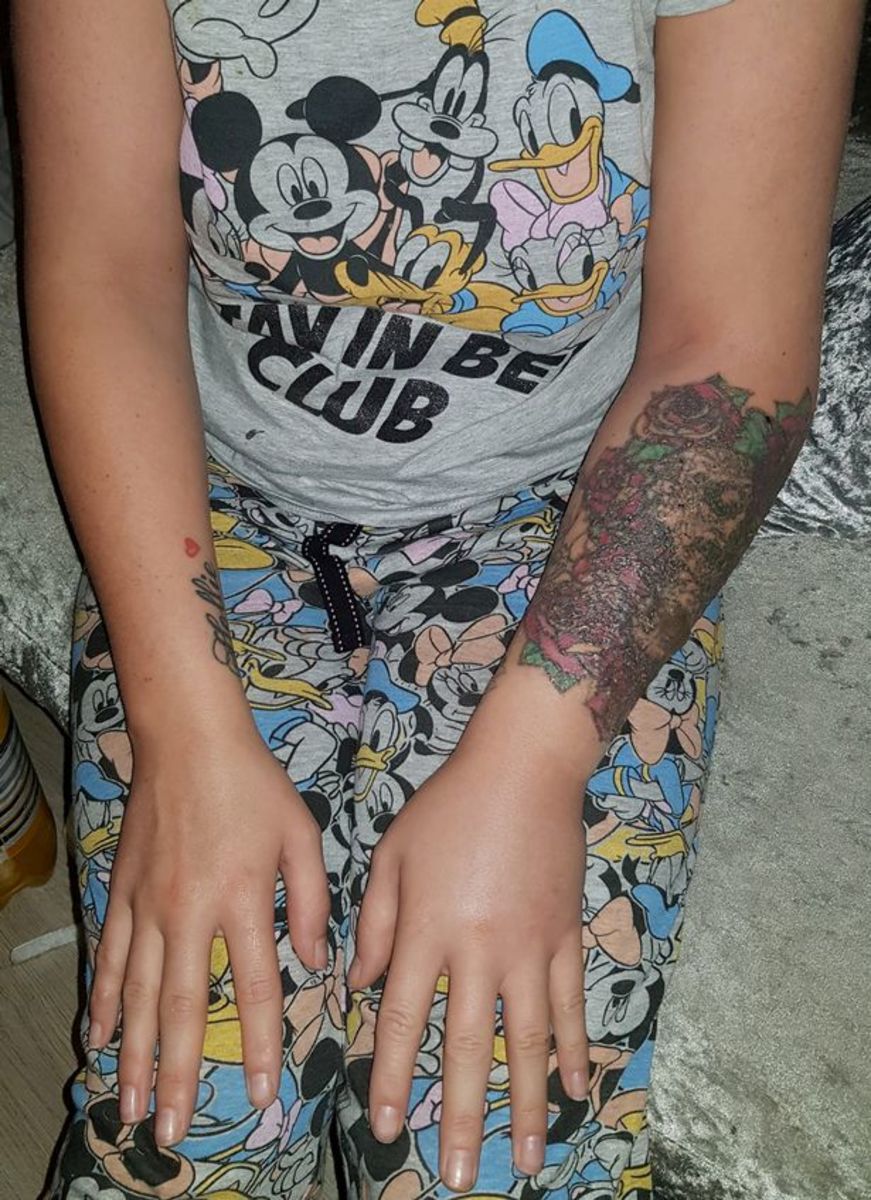 Stephanie lynn, maso jí chyby, odstranění tetování pokazilo, odložit svatbu, nový obličej, odstranění laserem, odstranění tetování