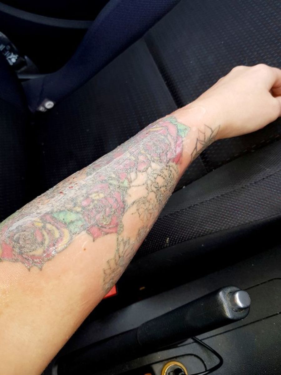 Stephanie lynn, maso jí chyby, odstranění tetování se pokazilo, odložit svatbu, nový obličej, odstranění laserem, odstranění tetování