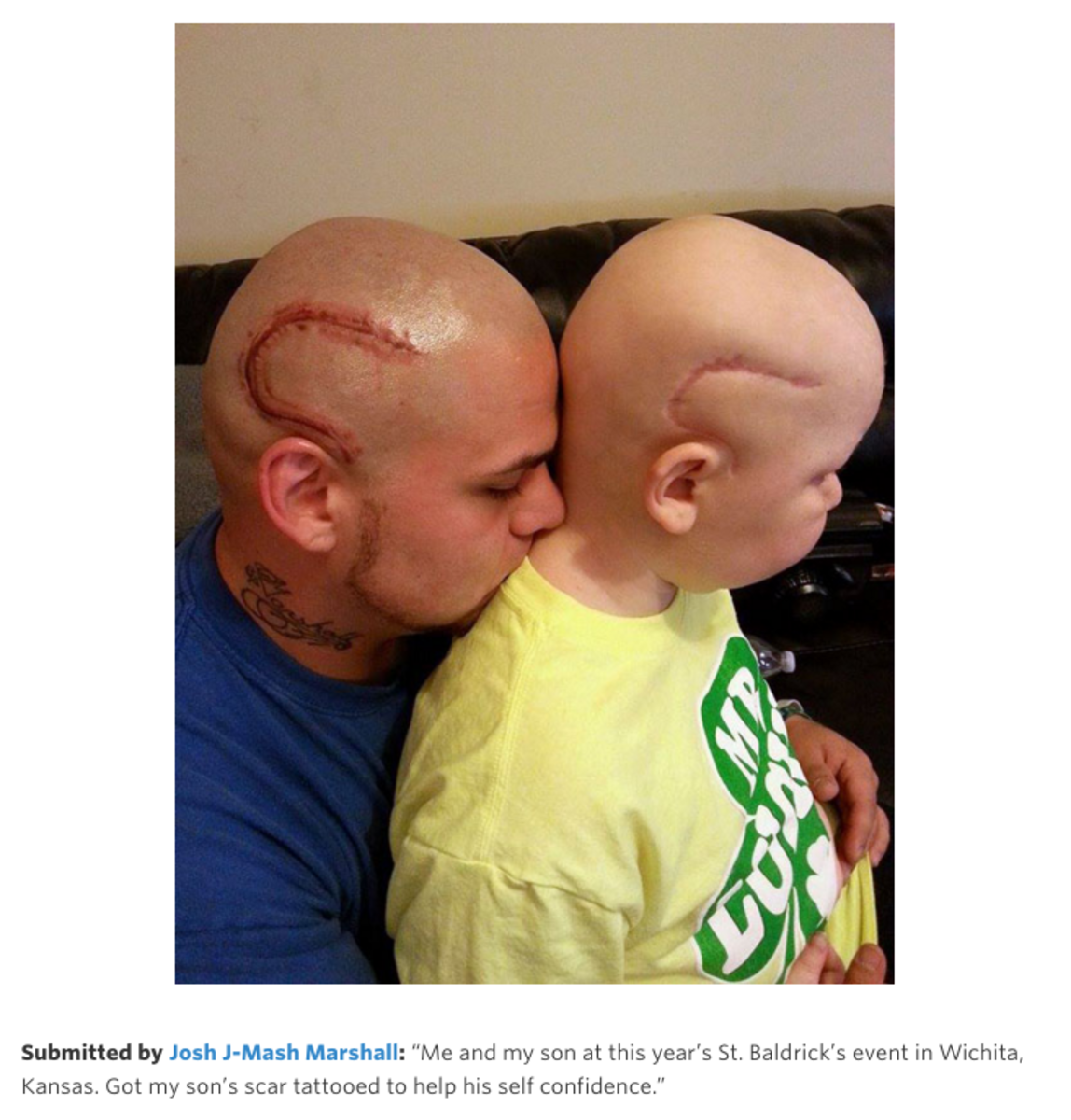 st baldrick's #bestbalddad