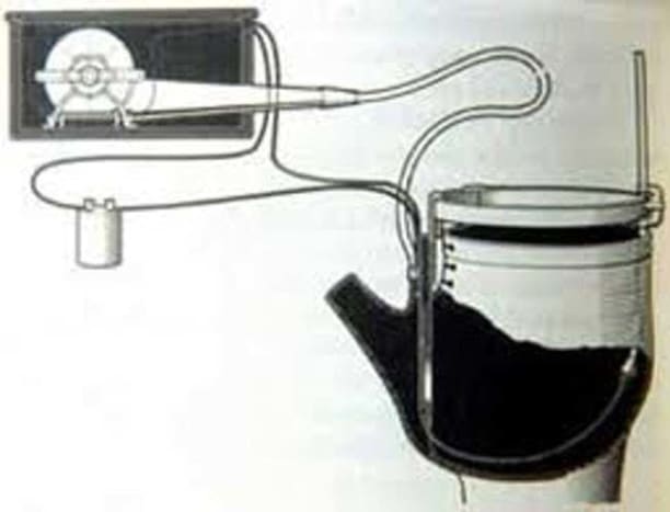 Foto via pinterestEs war im Jahr 1893, als ein Mann namens Frank Orth ein bestehendes Patent für nächtliche wasserdichte Hosen perfektionierte. So funktioniert es. Du hast nachts diese wasserdichte Hose angezogen. Sie sind mit einem Kaltwasserreservoir verbunden. Dein Penis sitzt zwischen zwei Hebeln. Sie bekommen eine Erektion. Die Hebel bewegen sich. Sie öffnen ein Ventil und Ihr Penis wird in kaltem Wasser gebadet. Keine Erektion mehr!