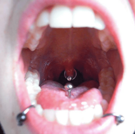 šílené piercingy v ústech