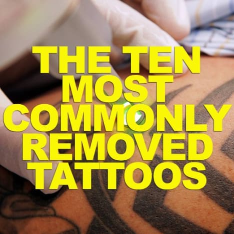 KLICKEN SIE HIER, um die 10 am häufigsten entfernten Tattoos zu sehen!