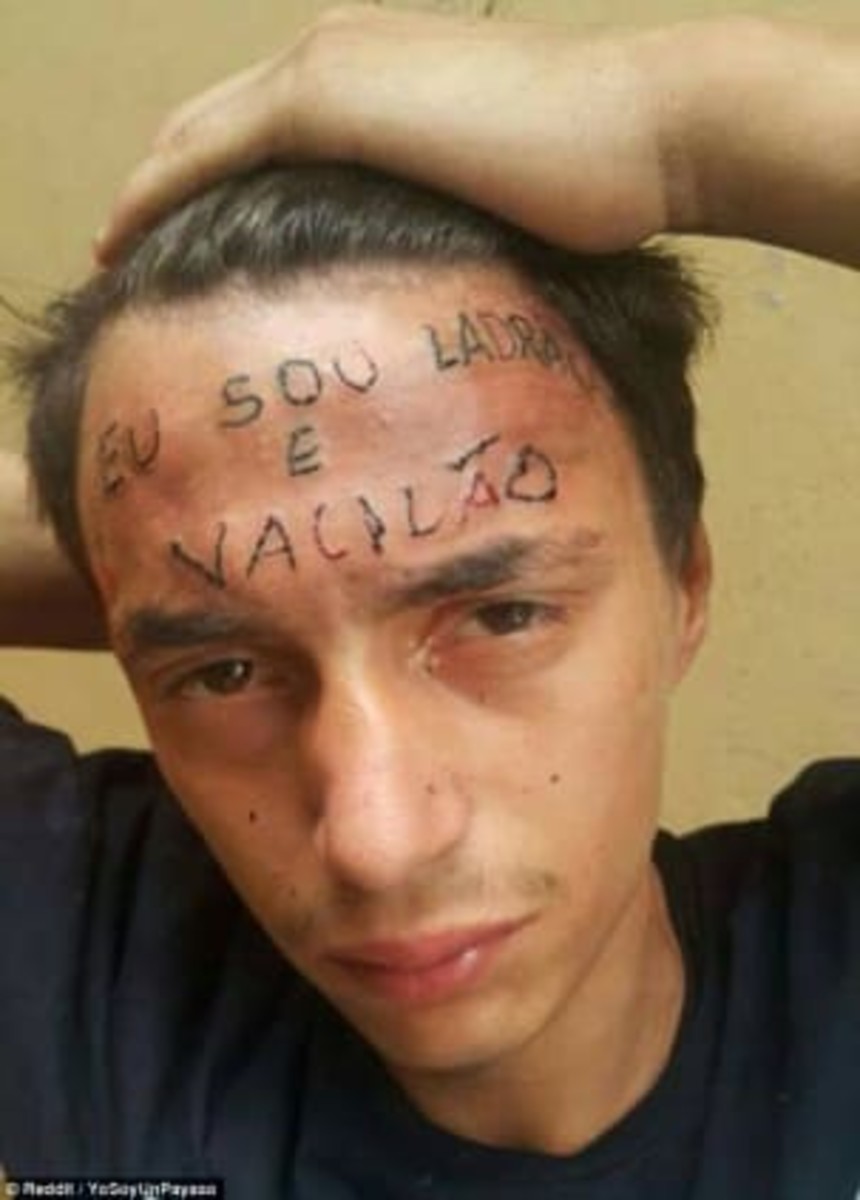 Aconteceu no Vale, eine brasilianische Nachrichtenwebsite, berichtete, dass eine Online-Kampagne zur Geldbeschaffung und Zahlung für die Entfernung des Tattoos ins Leben gerufen wurde und bereits 20.000 brasilianische Real (8.400 US-Dollar) gesammelt hat, was das Ziel von 15.000 brasilianischen Real übertroffen hat.
