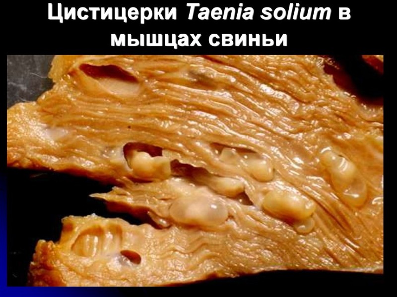 carne contaminada