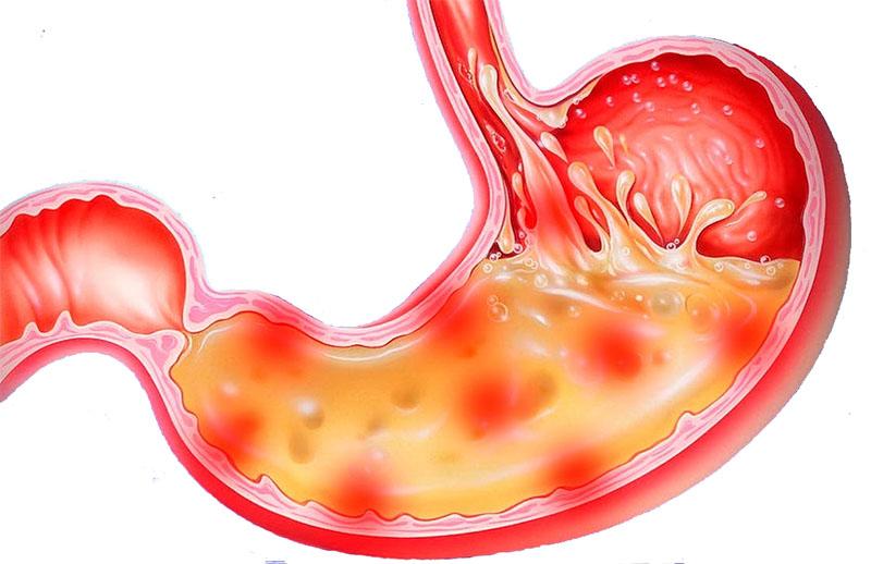 Propiedades útiles de las caléndulas y contraindicaciones para la gastritis.