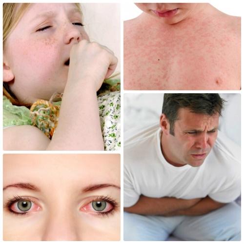 síntomas de alergia